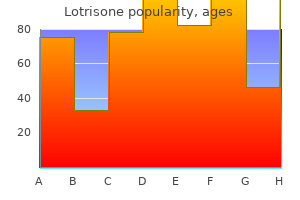 buy genuine lotrisone online