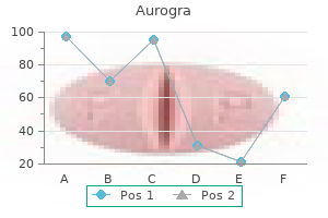 buy 100mg aurogra mastercard