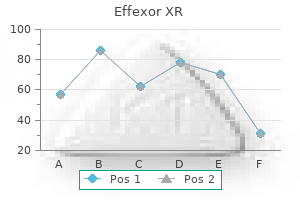 generic 75mg effexor xr fast delivery