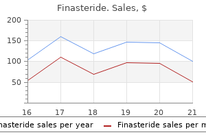 order cheap finasteride on line