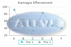 order generic kamagra effervescent