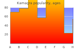 kamagra 50 mg without prescription