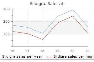 order 50 mg sildigra