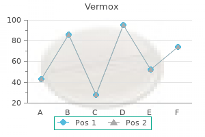 vermox 100 mg with amex