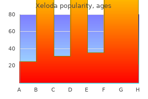 buy generic xeloda canada