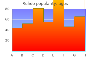 purchase rulide 150 mg online