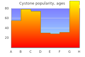best buy for cystone