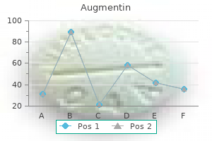 375mg augmentin mastercard