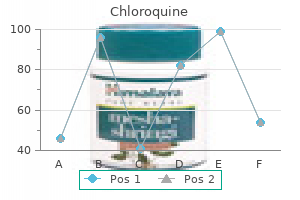 order 250mg chloroquine mastercard