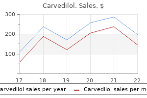 discount 12.5mg carvedilol visa