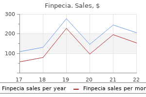 cheap 1mg finpecia with amex