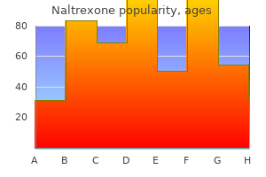 buy naltrexone 50mg overnight delivery