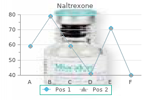 discount naltrexone 50mg without prescription