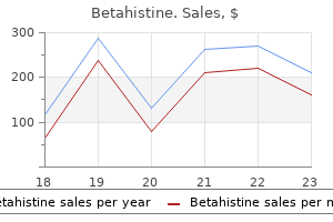 buy 16 mg betahistine amex