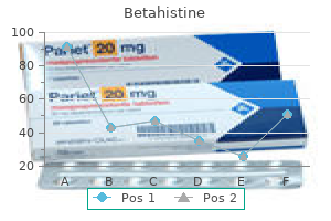 buy 16 mg betahistine visa