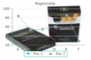 order ropinirole 1 mg with mastercard