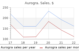 generic 100 mg aurogra free shipping