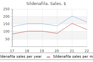 purchase 25 mg sildenafila