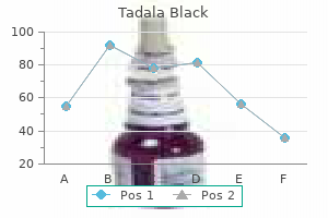 order line tadala black