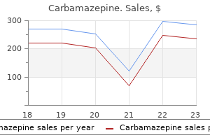 carbamazepine 200mg with visa